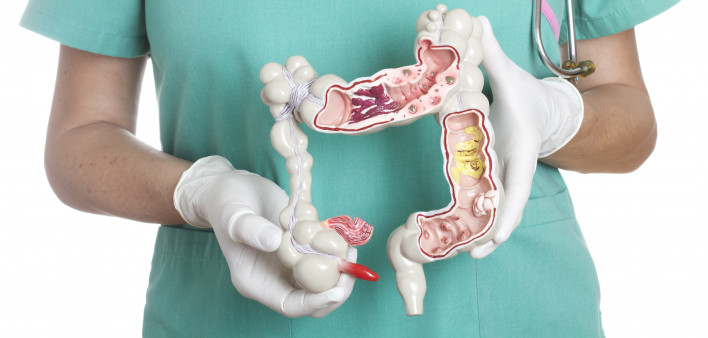 Colon Canser Treatment